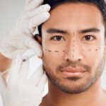 Chirurgie esthétique : avec ou sans TVA ?