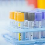 Responsabilité élargie des producteurs de textile : une aide financière ajustée